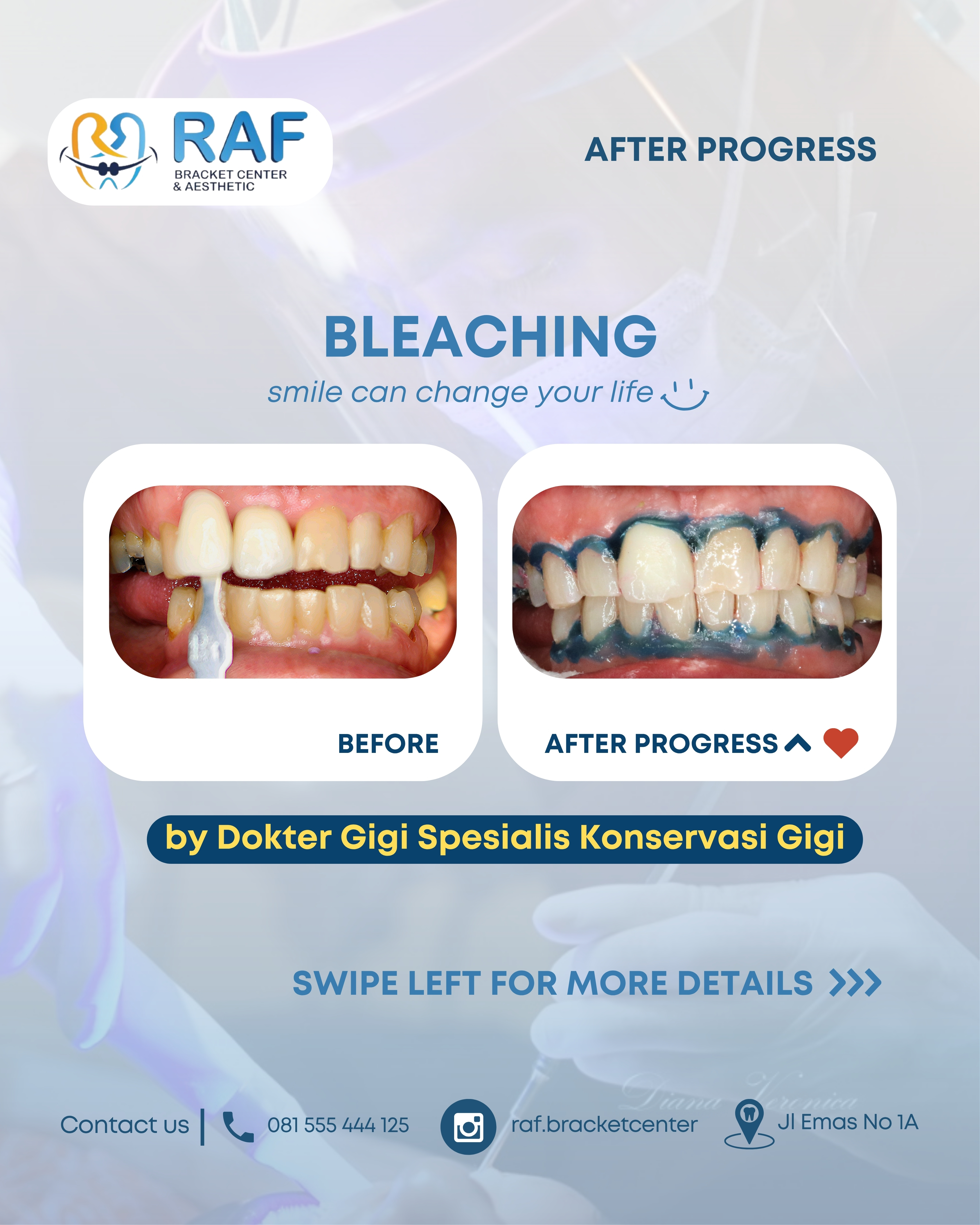 Bleaching